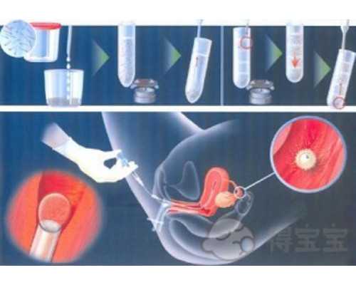 宫颈疫苗对应年龄